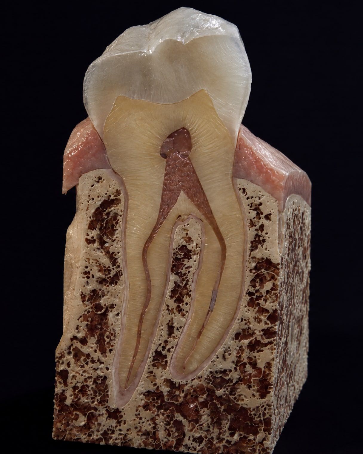 Concept visualization of a tooth root, the periodontal ligament and the alveolar bone in cross-section