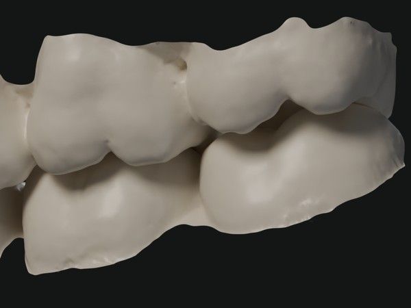 3D concept visualization of upper and lower molars meeting